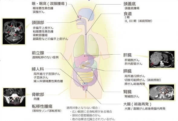 適応疾患