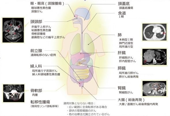 適応疾患