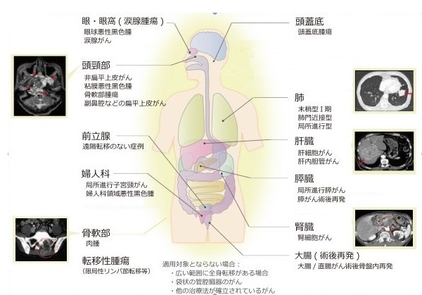 適応疾患