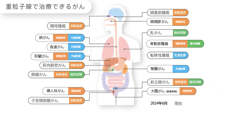 疾患別の適用図