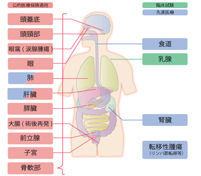 重粒子線治療の適応