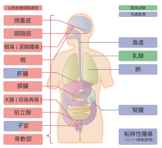 重粒子線治療の適応