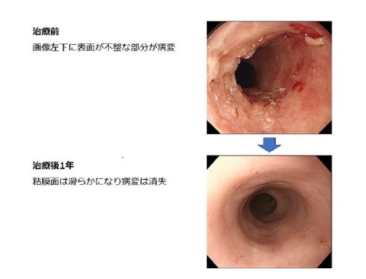 症例の紹介