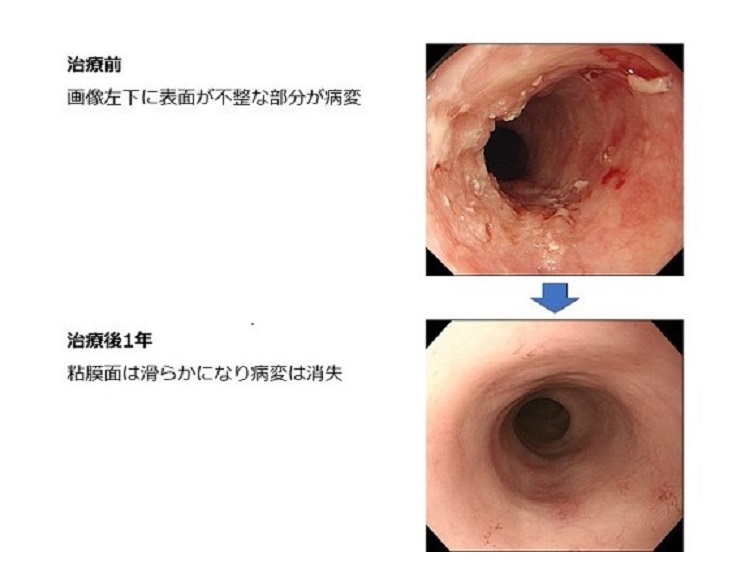 症例の紹介